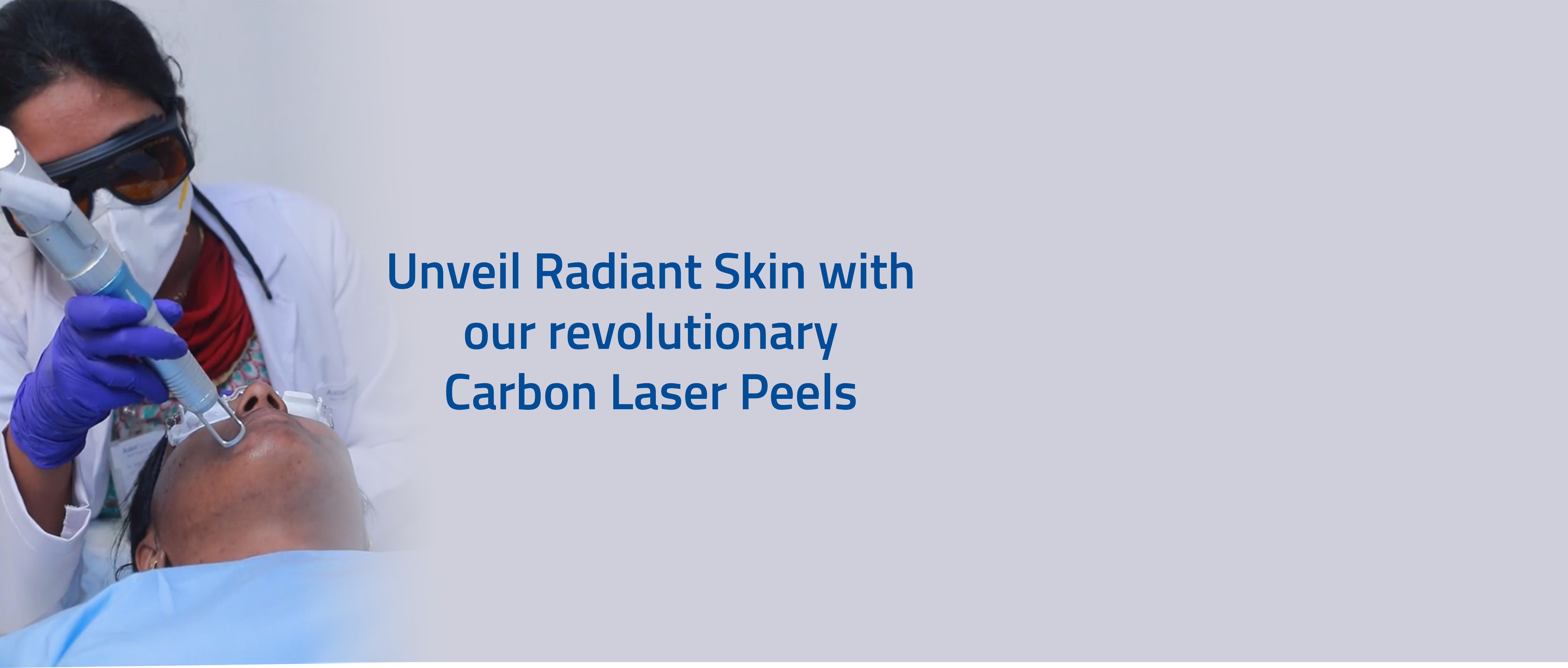 Carbon laser peel