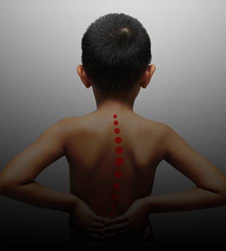 paediatric spine surgery aster medcity kochi