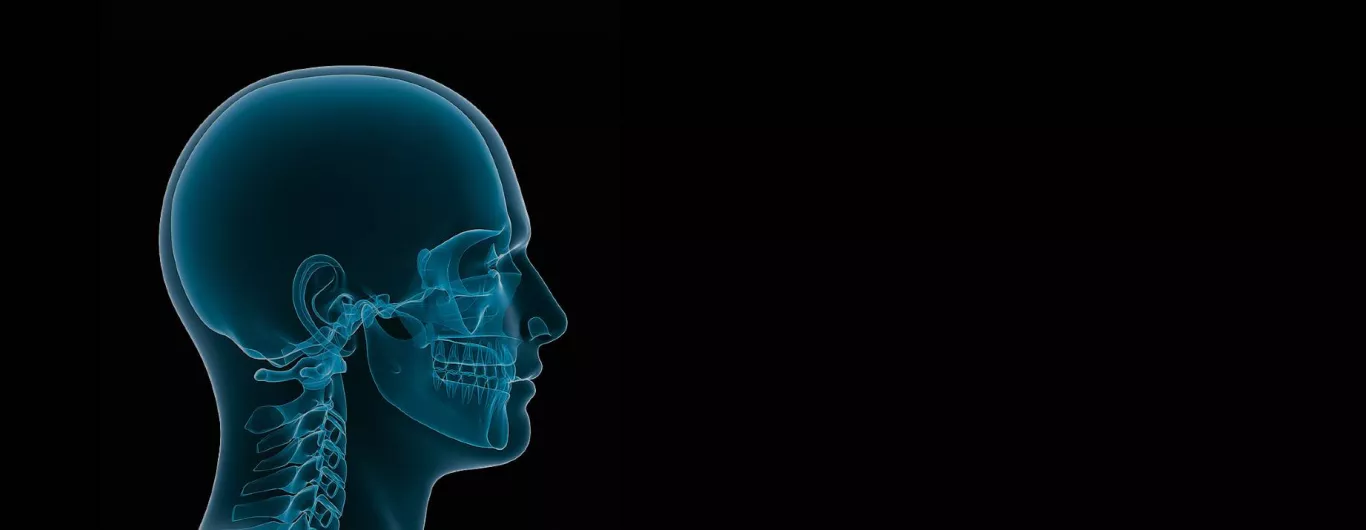 craniomaxillofacial surgery in india
