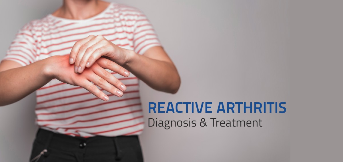 Symptoms And Treatment Of Reactive Arthritis 