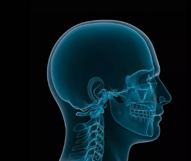 Craniomaxillofacial Surgery 