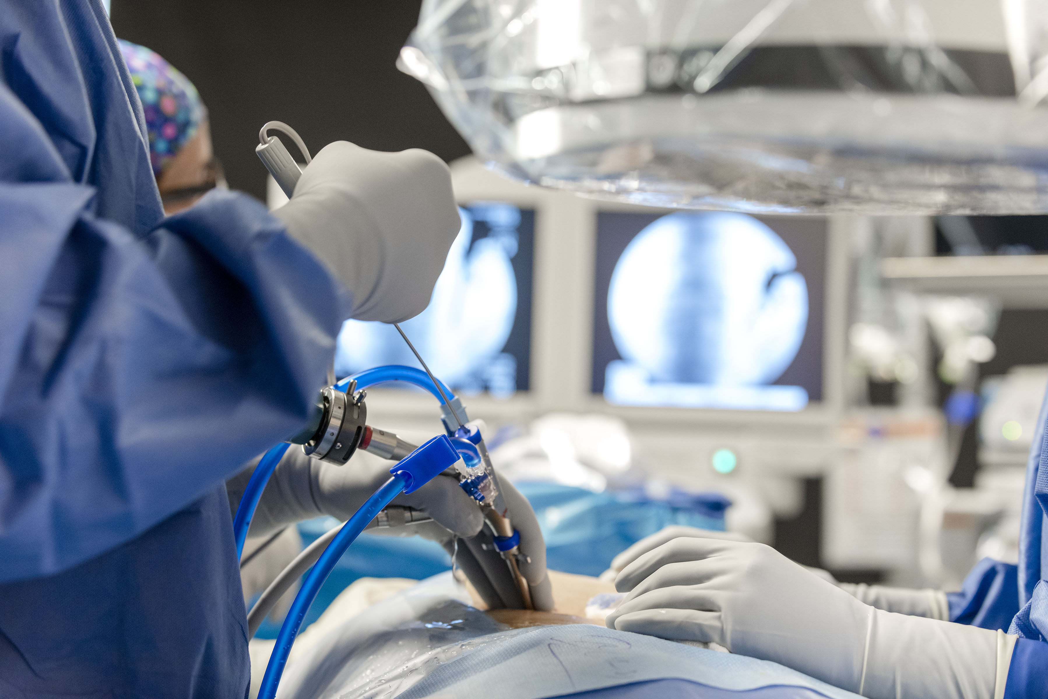 Endoscopic Resection Procedures
