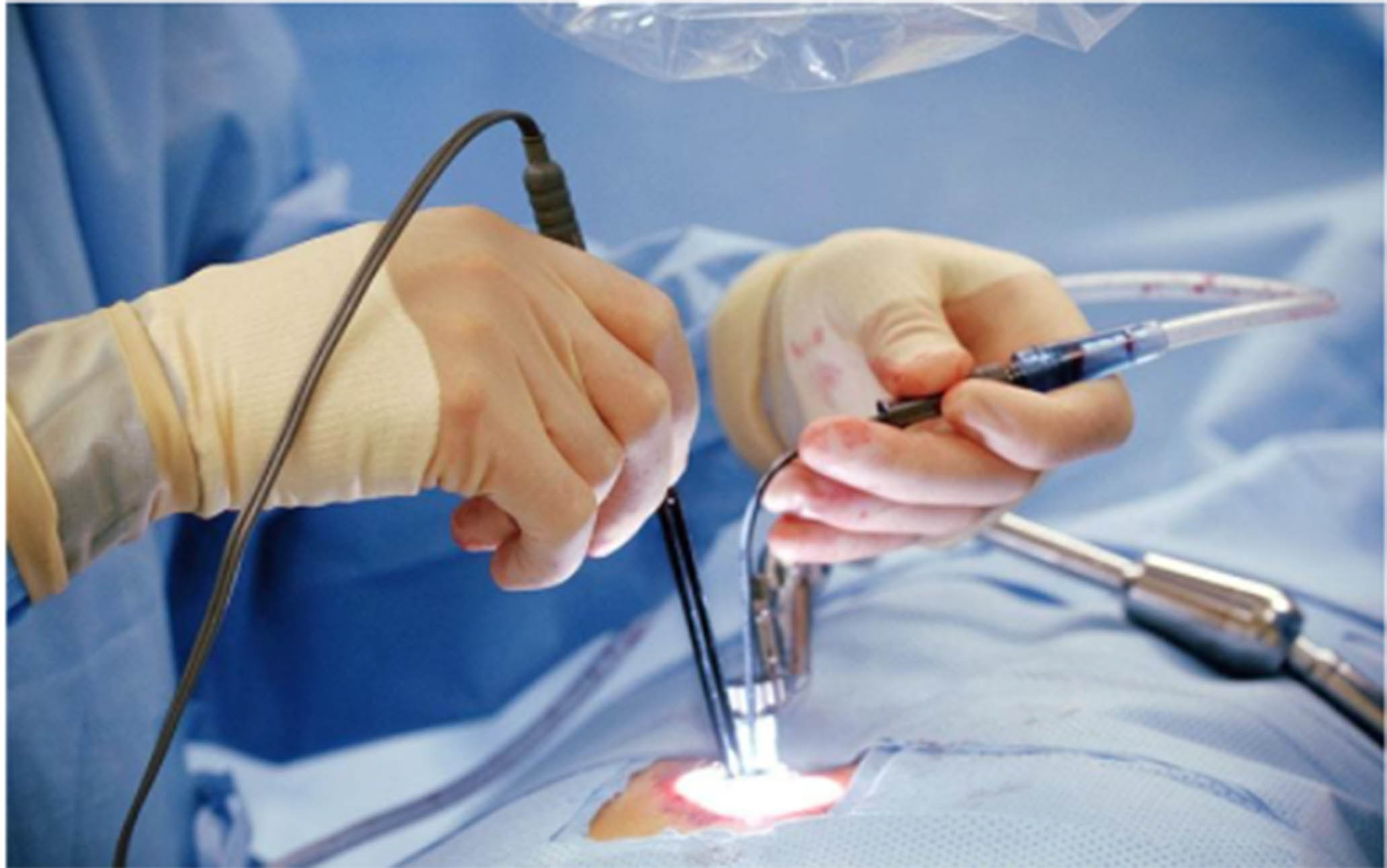 Minimally Invasive Surgeries