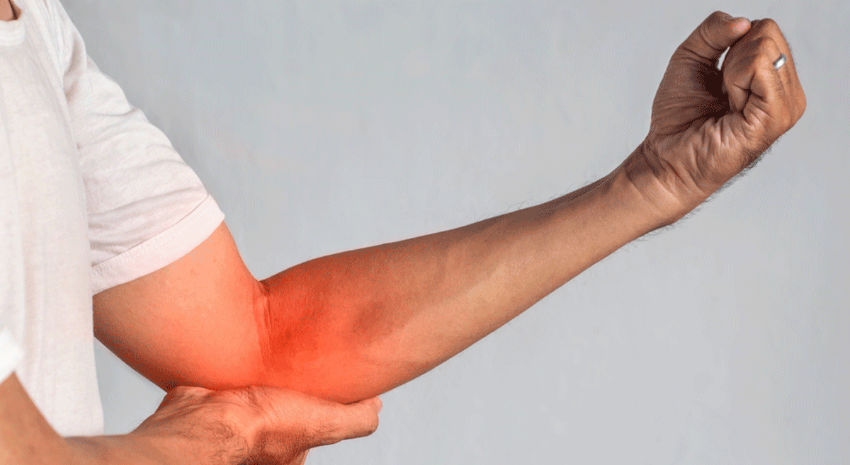 Cubital Tunnel Syndrome Signs And Treatment