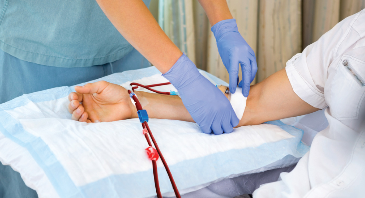 Arteriovenous Fistula care in Patients on Hemodialysis Aster