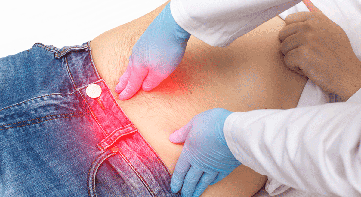 Hernia Treatment