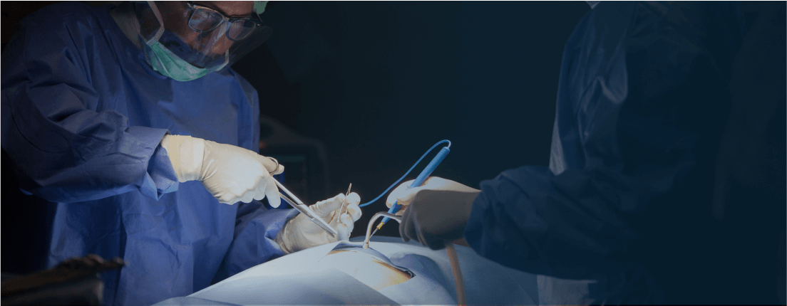 Hysterectomy Surgery