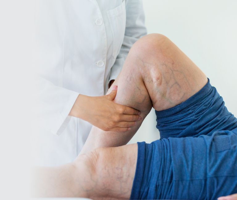 vascular diseases