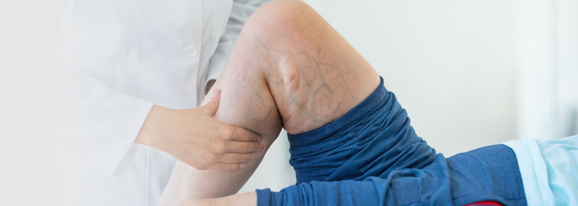 vascular diseases