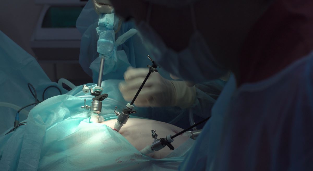 Understanding Laparoscopic Surgery