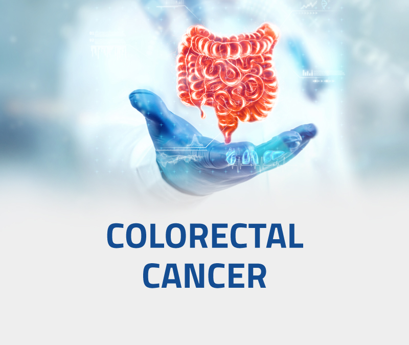 colorectal cancer