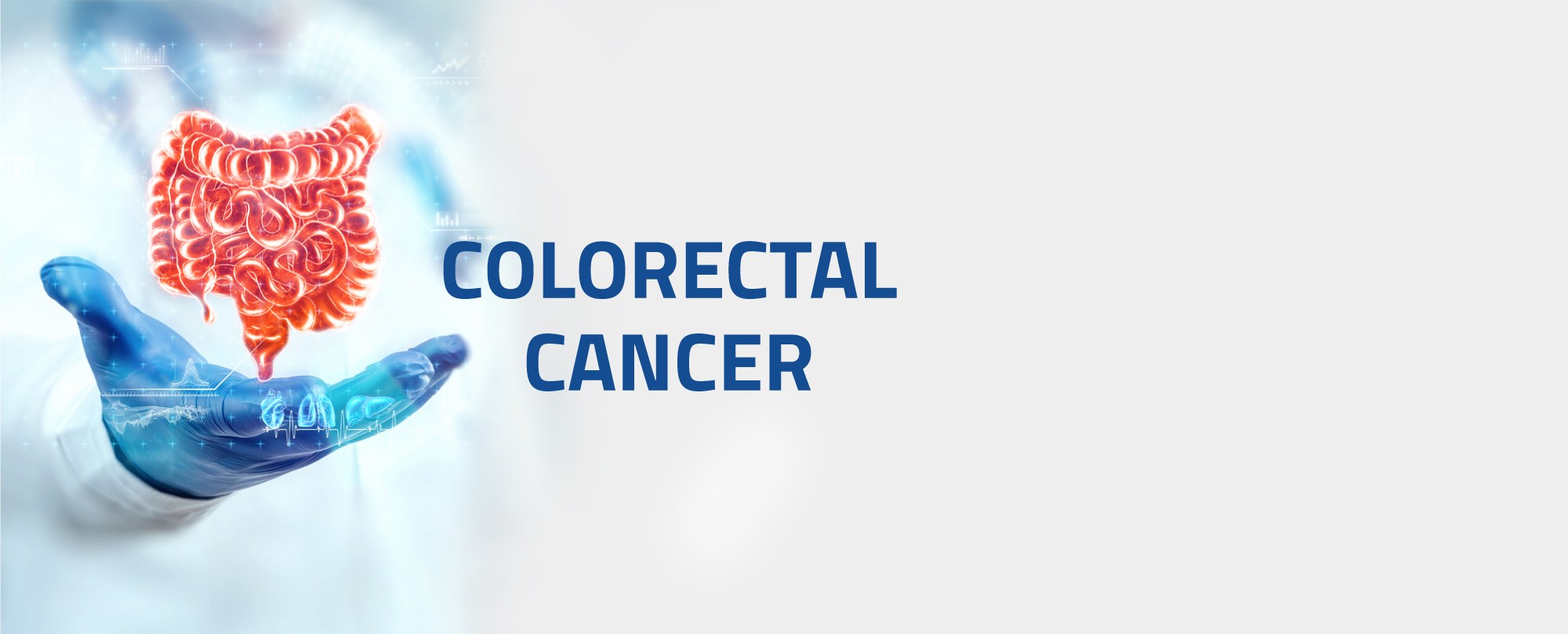 colorectal cancer