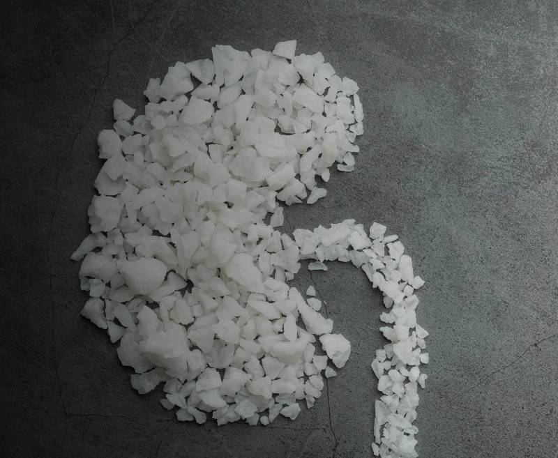 Kidney stone treatment in kannur