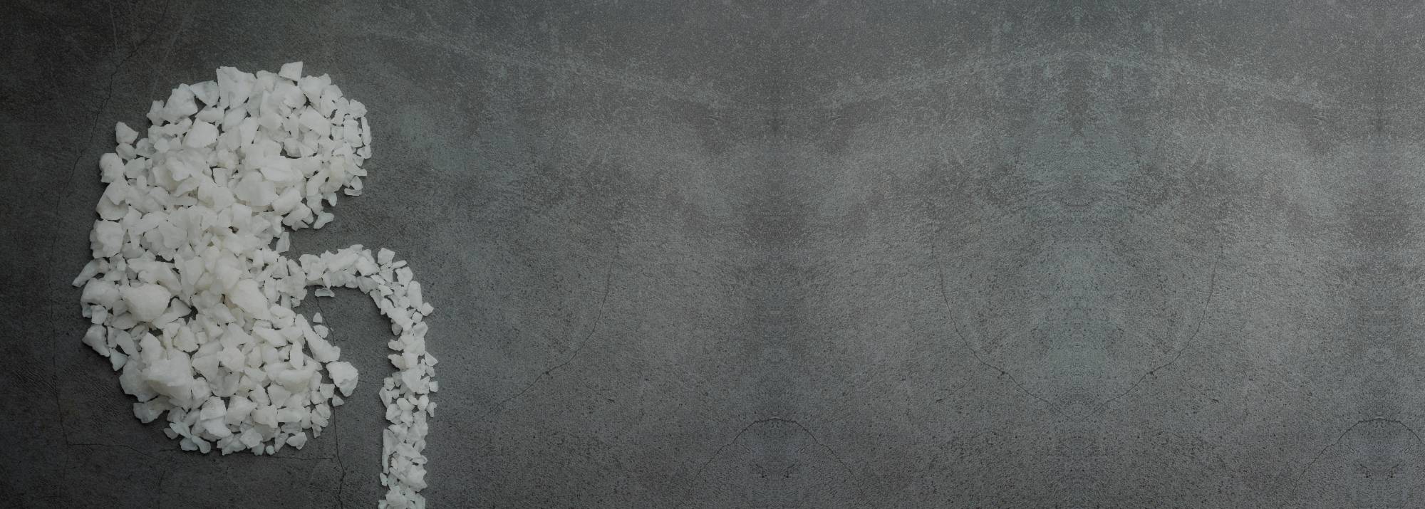 Kidney stone treatment in kannur