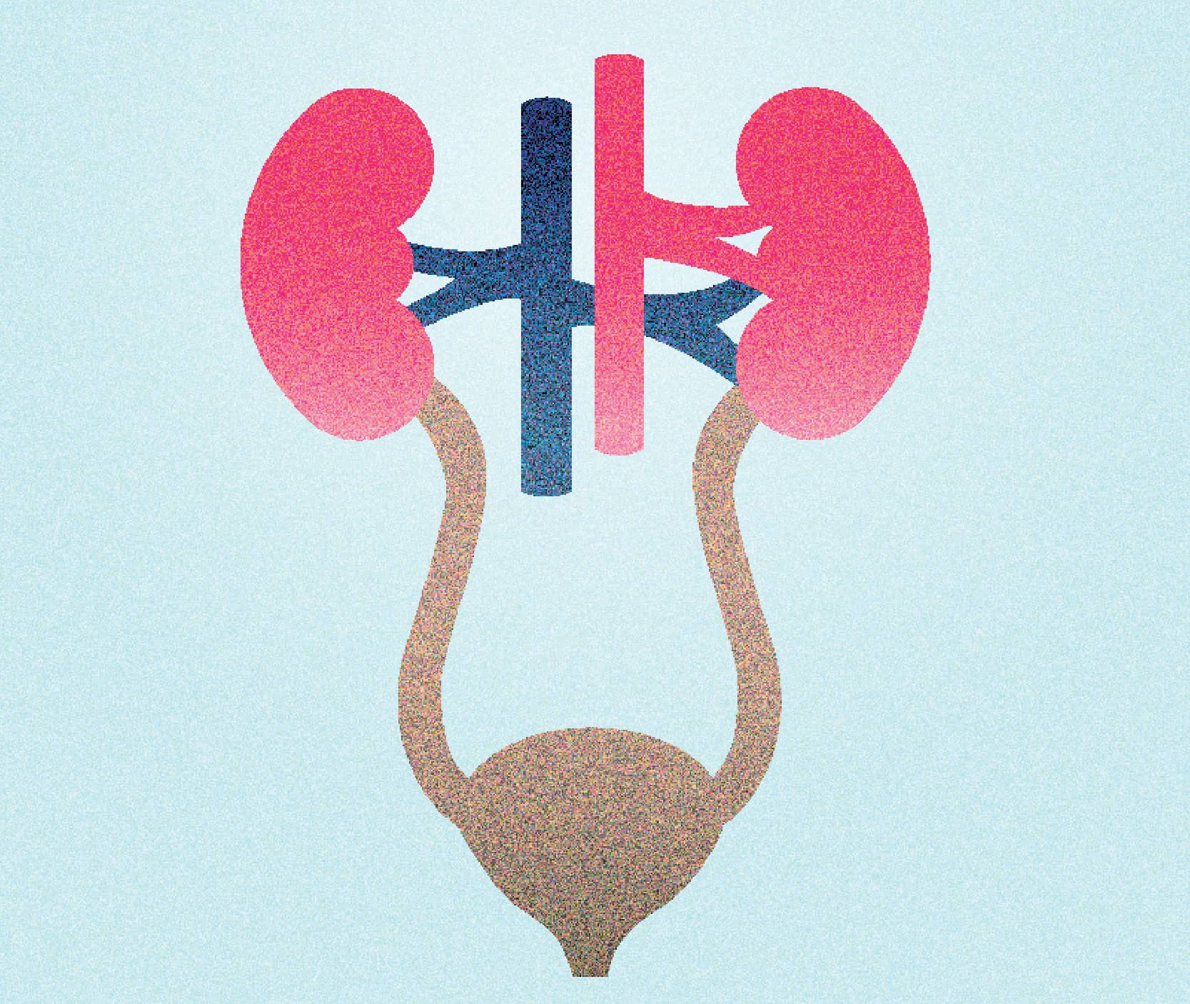Aster Whitefield Urology
