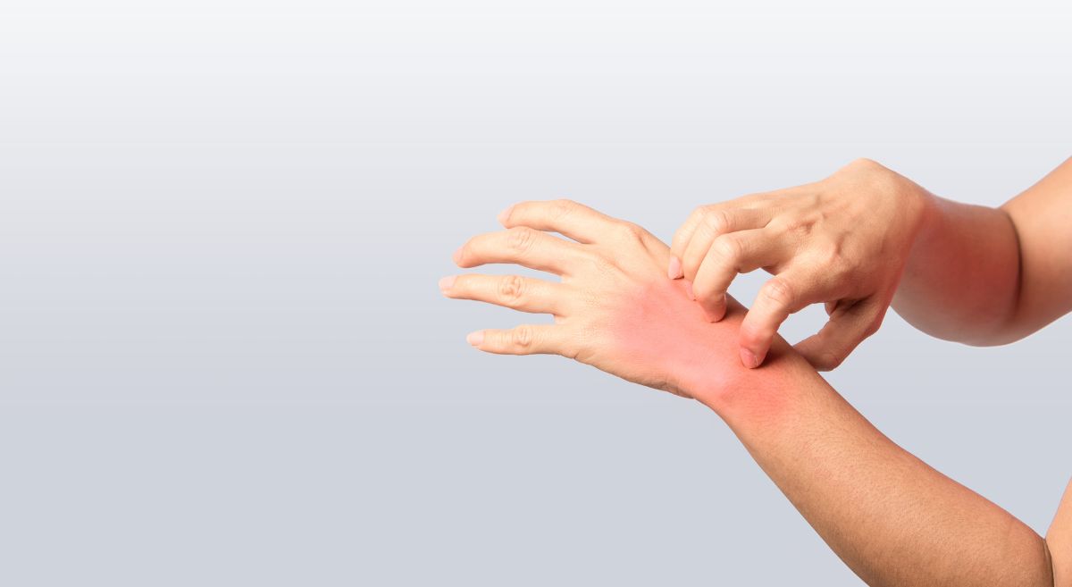 Why does your skin suffer as the weather changes 