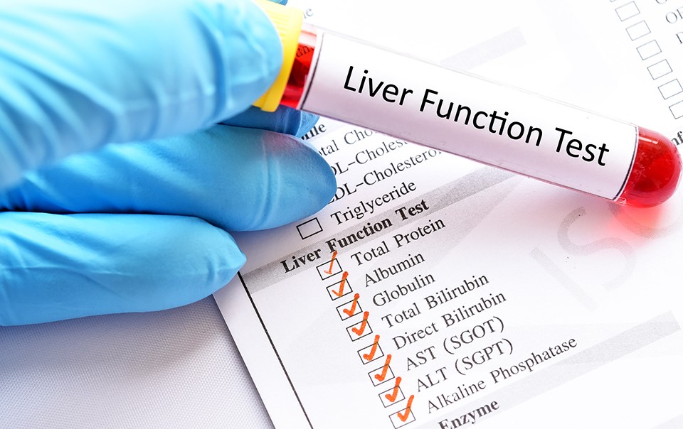 Liver testing 