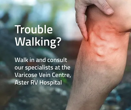 Varicose Veins Mobile Banner