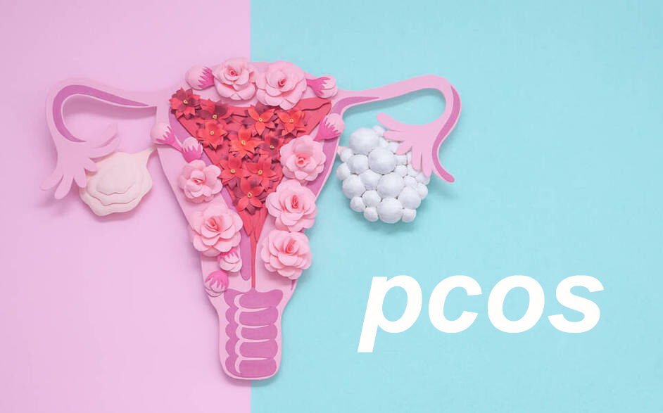 PCOS