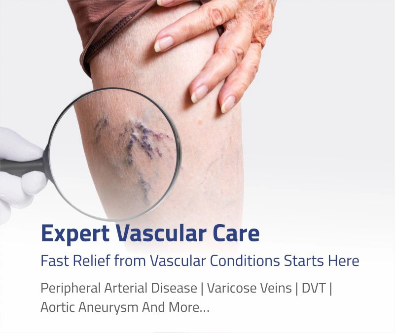 Vascular banner Mobile