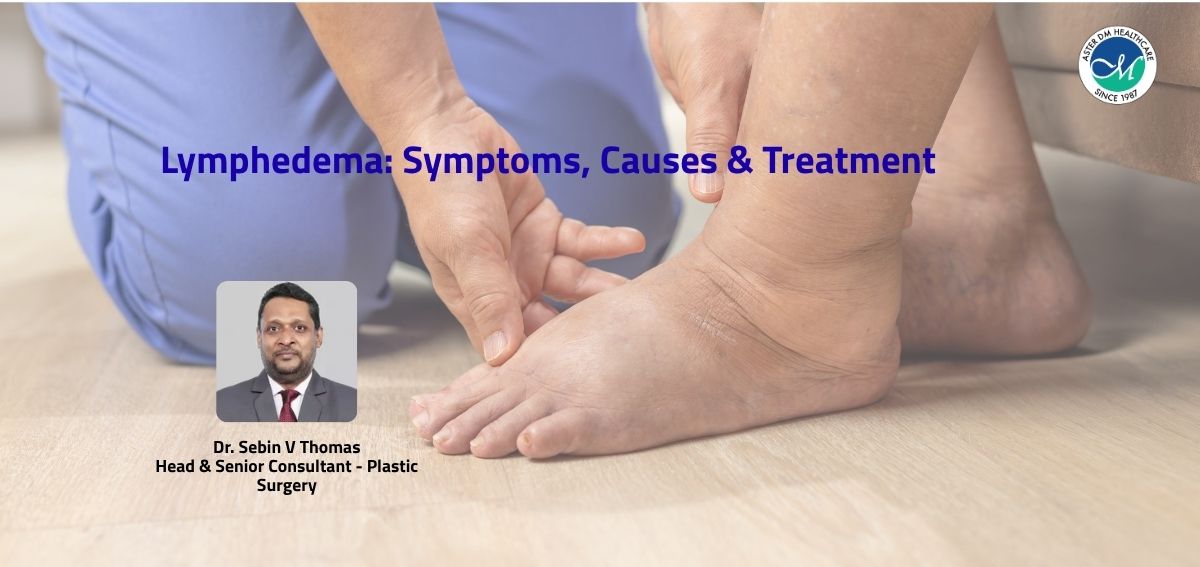LYMPHEDEMA CLINIC