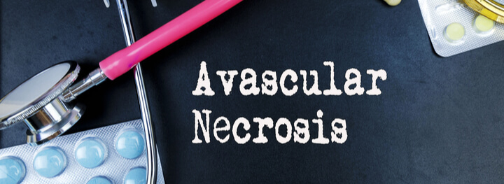 avascular-necrosis-treatment-bangalore-aster-rv-hospital