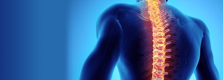 spinal-cord-abnormality-21