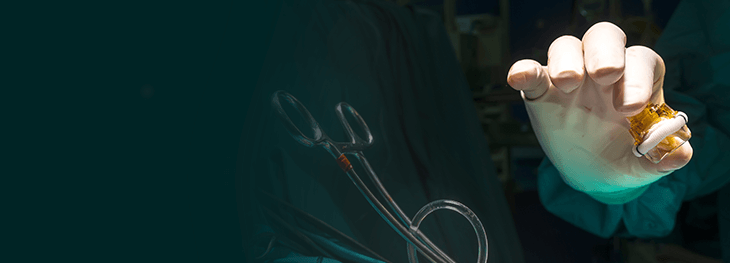 transcatheter-aortic-valve-replacement-2