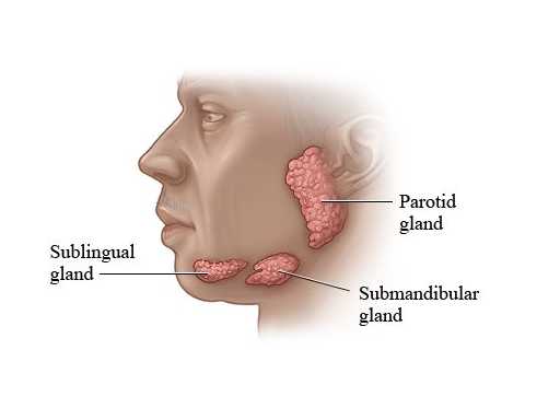 Parotidectomy