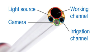 Spine surgery endoscopic