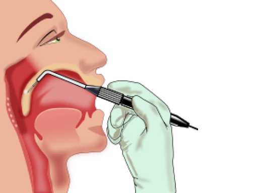 Sleep apnoea management