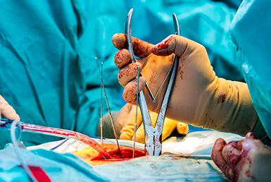 Traditional Spine Surgery