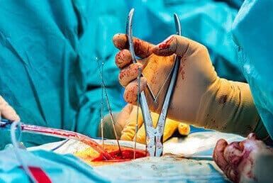 Traditional Spine Surgery