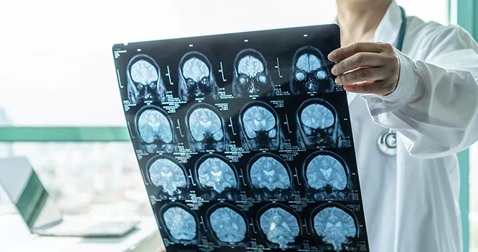 neuro care