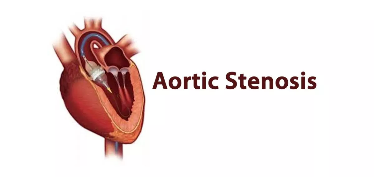 Aortic Stenosis