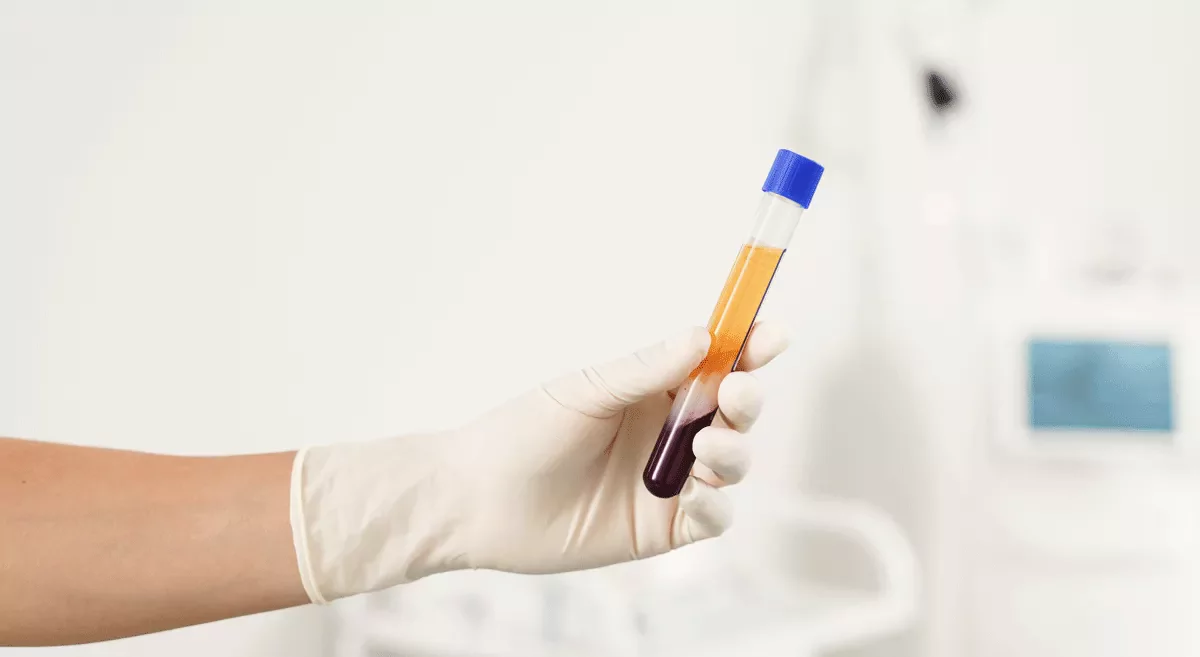 Platelet Rich Plasma Therapy