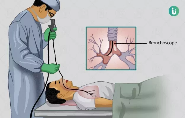 Bronchoscopy