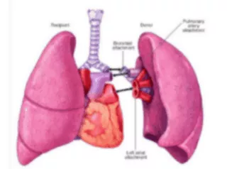 Single lung transplantation