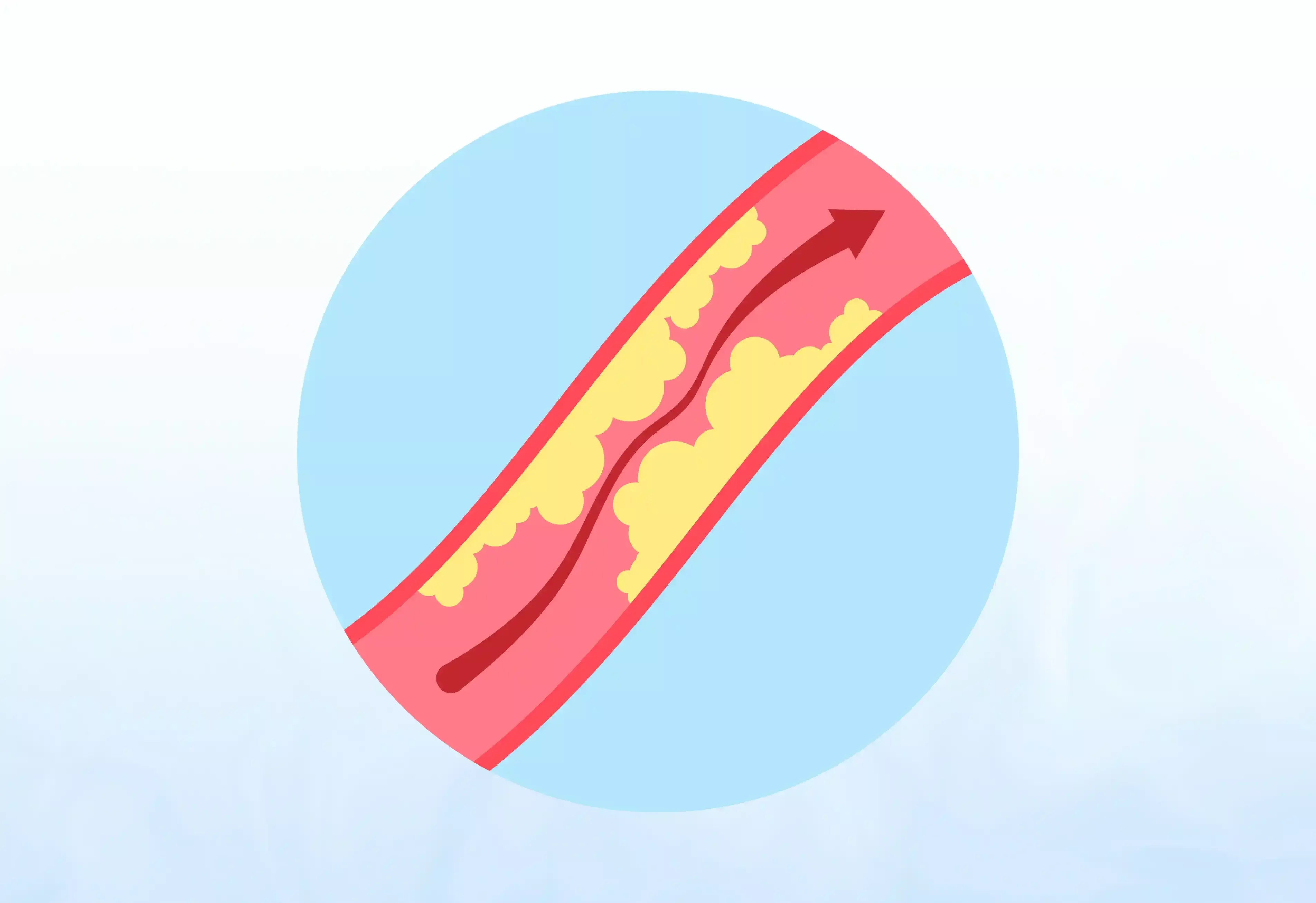 Aortic and Peripheral Vascular Surgery