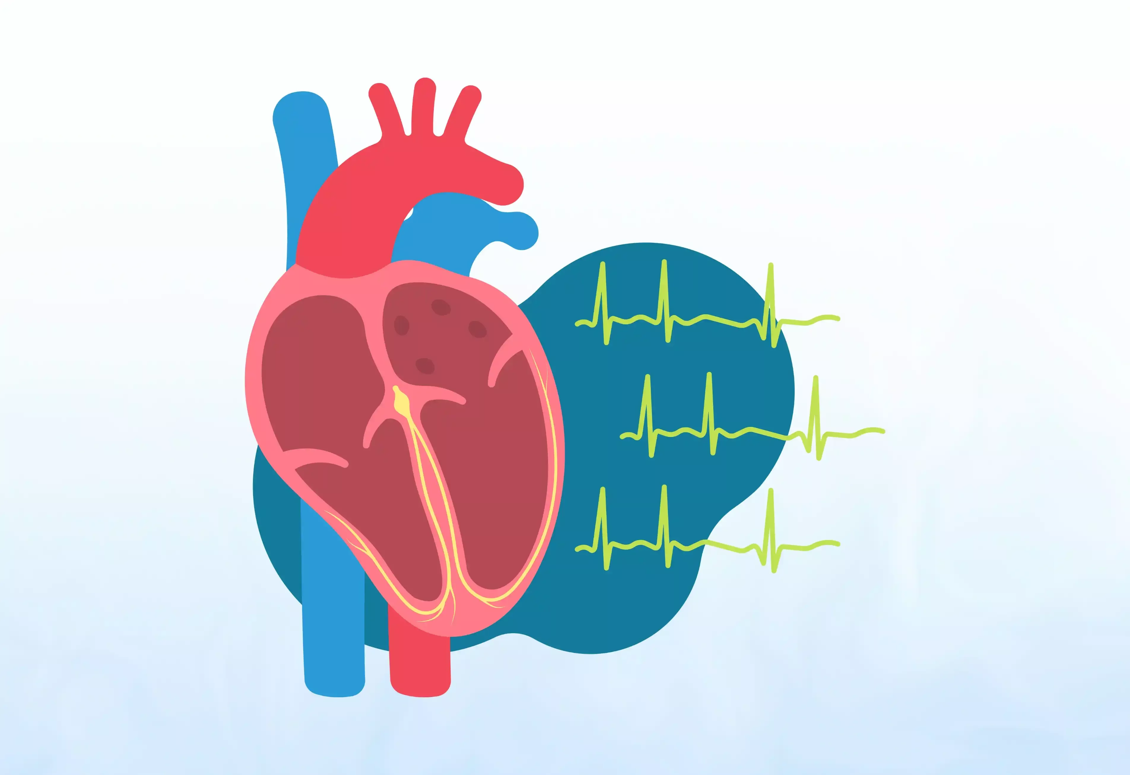 Arrhythmia Management