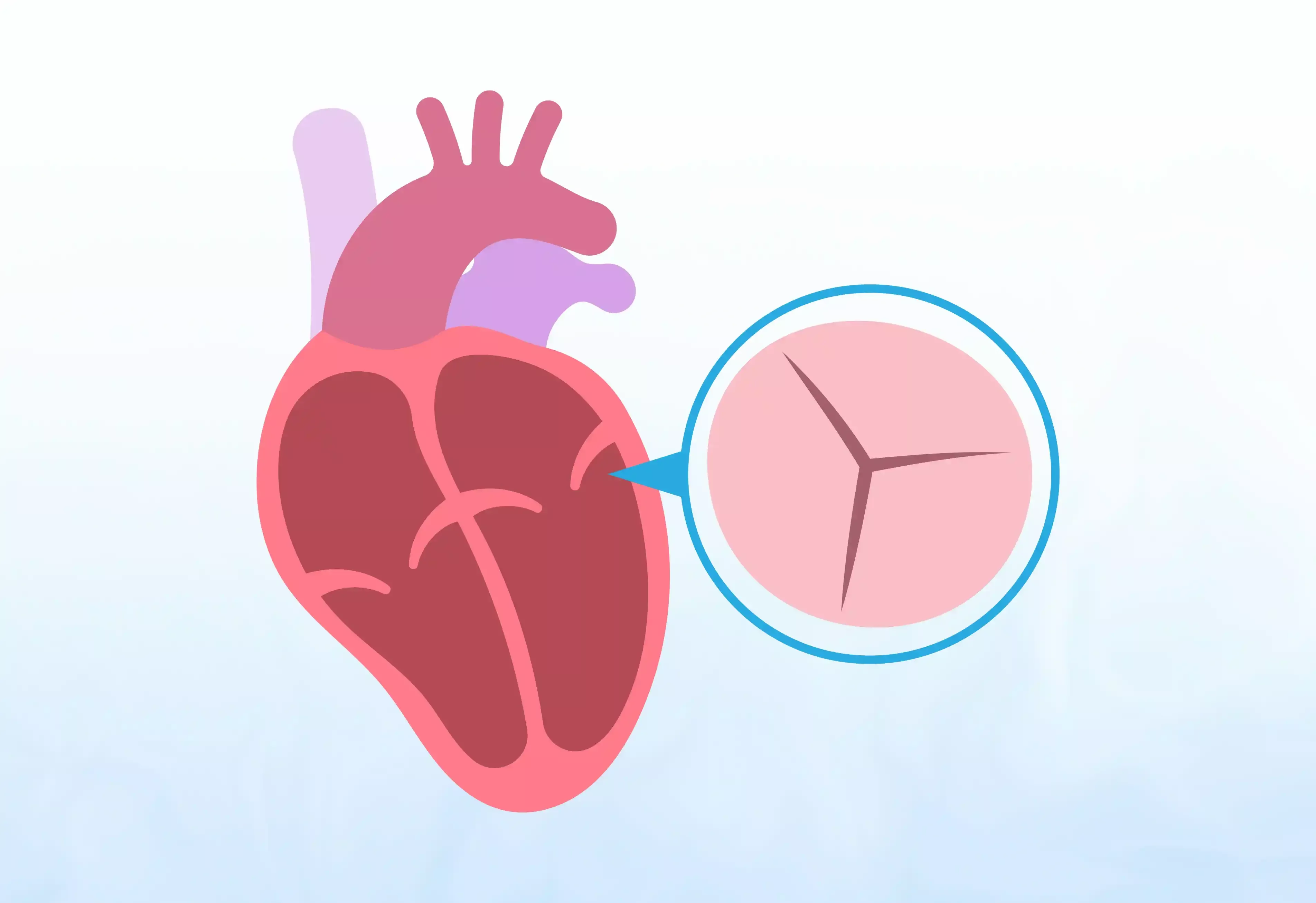 Valvular-Interventions