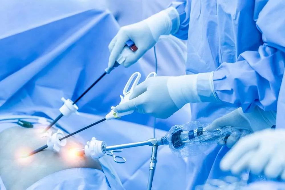 Laparoscopic surgery