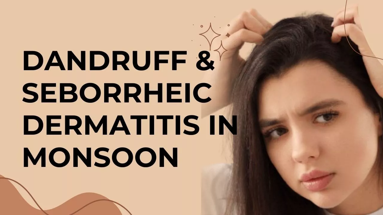 Dandruff