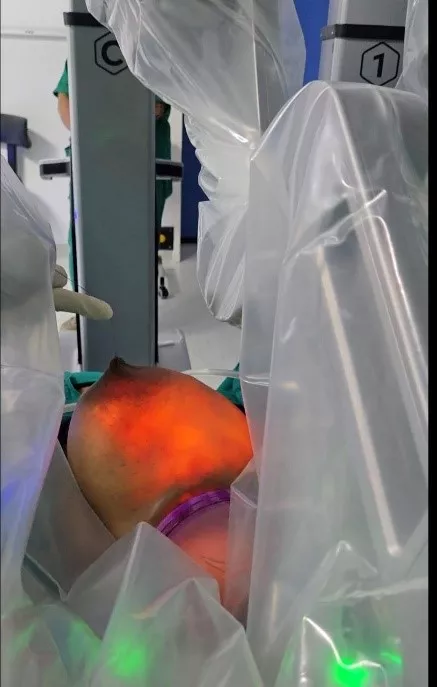 Breast Carcinoma 2.1