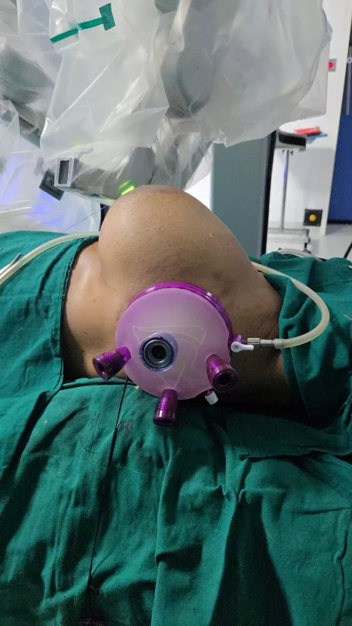 Breast Carcinoma 2.3