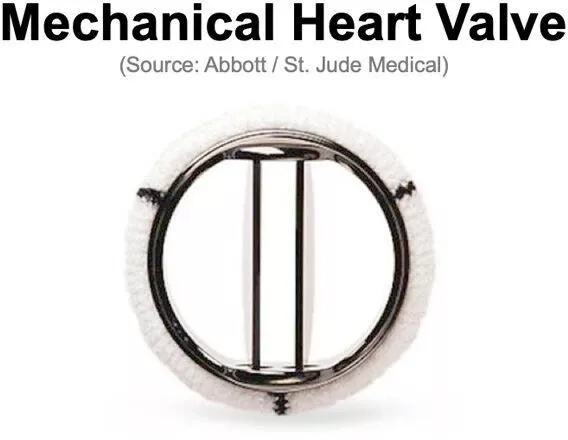 Figure 1. St jude mechanical heart valve.jpg