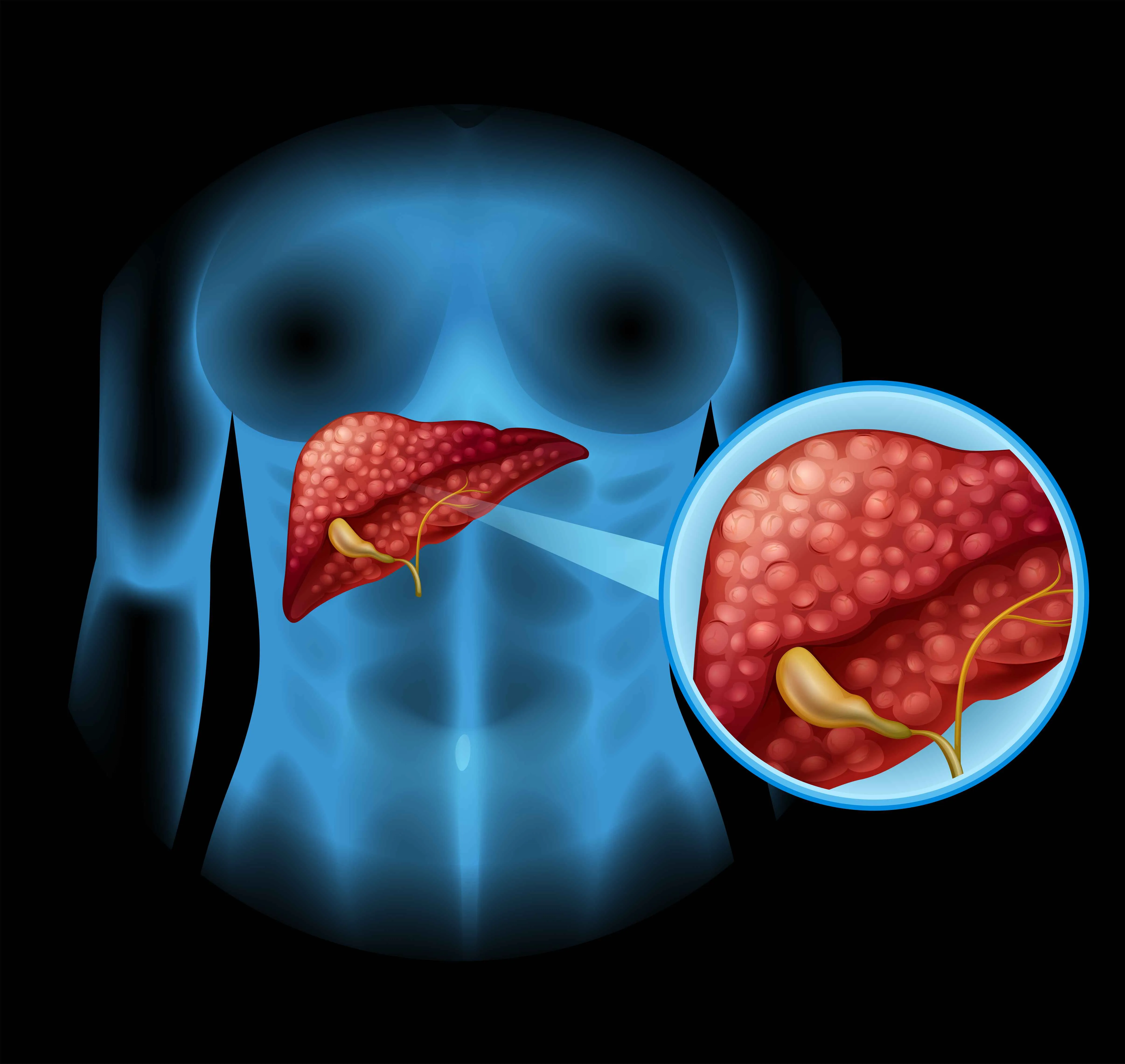 gallbladder