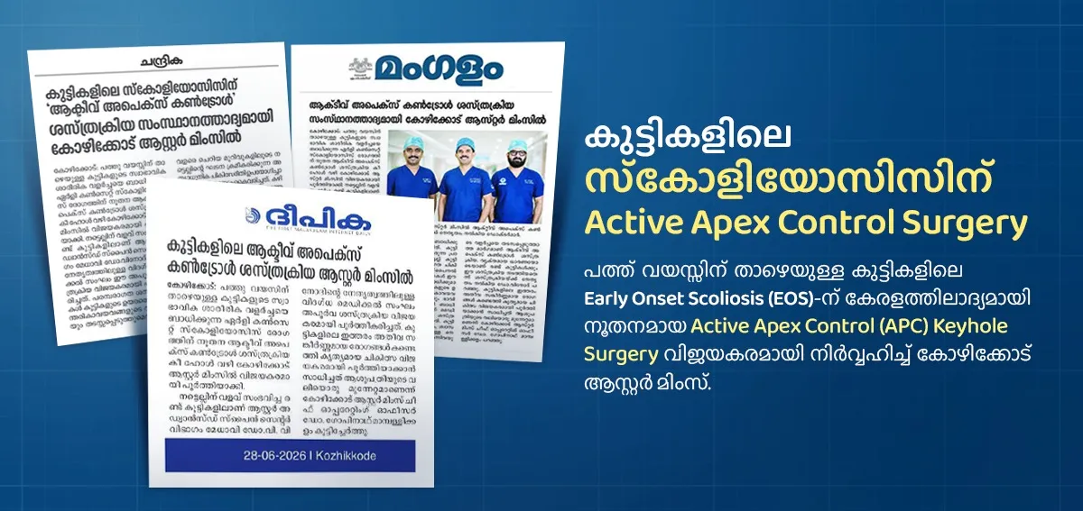 Scoliosis treatment in calicut