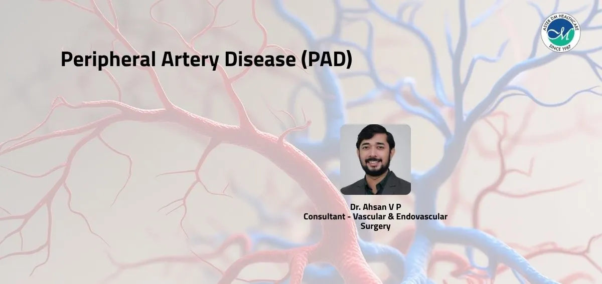 Vascular &amp; endovascular surgeon in calicut