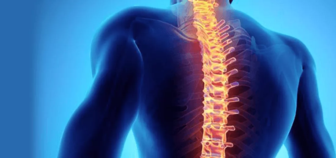spinal-cord-abnormality-21